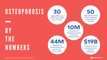 Osteoporosis stats by the numbers; average age, number of people affected, annual cost.
