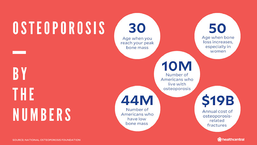 骨质疏松症的统计数字;平均年龄，受影响的人数，年花费。