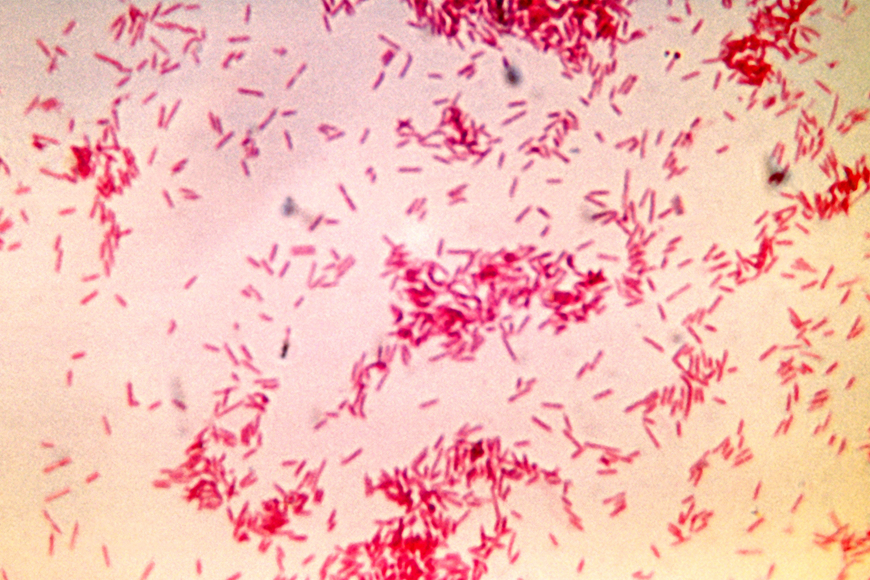 Бактерия spp. Фузобактерии микроскопия. Бактероиды по Граму. Бактероиды и фузобактерии. Возбудитель некробактериоза - Fusobacterium necrophorum.