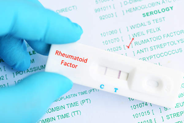 测试结果为类风湿因子。