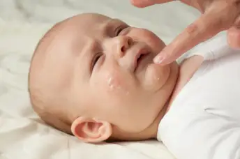 婴儿湿疹