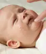 婴儿湿疹