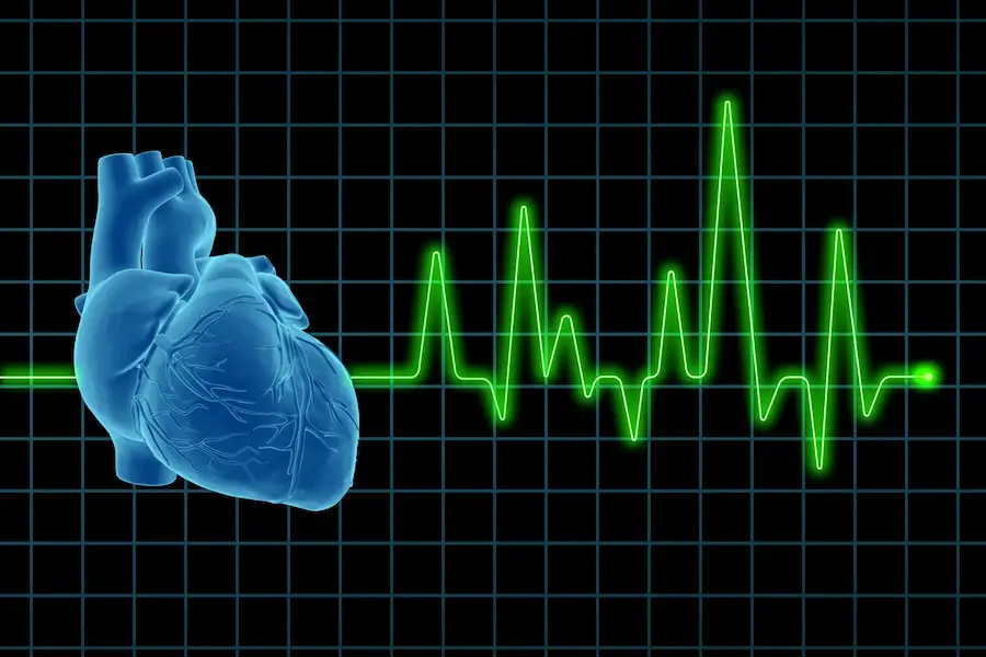 Heart rate during a heart attack: What to know