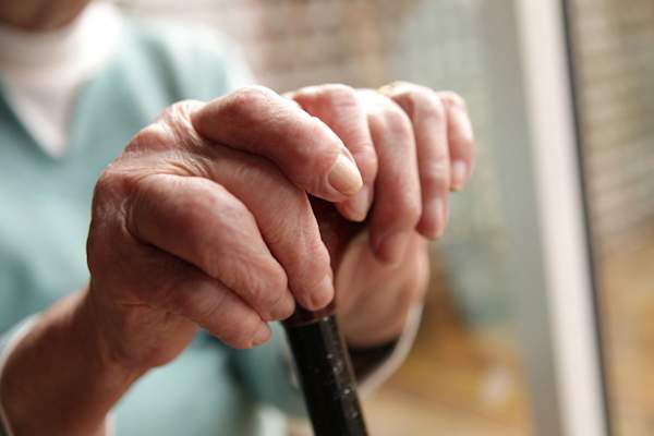 手指肿胀的老妇人