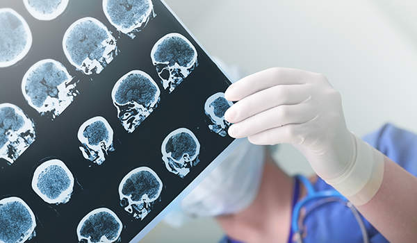 医生看在大脑扫描图像。