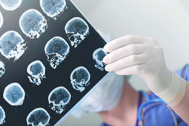 医生看在大脑扫描图像。