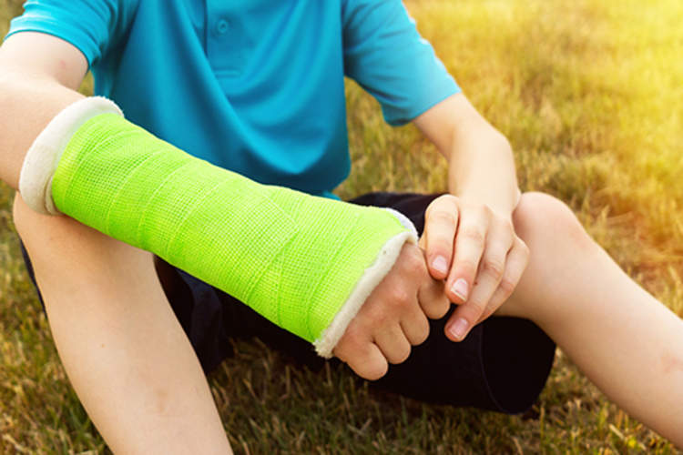 小男孩用手臂骨折戴着石膏。