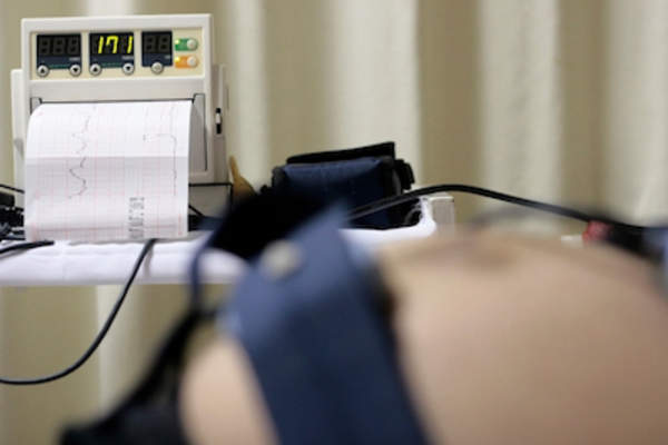 孕妇的胃被心电图钩住,观察婴儿的心跳。