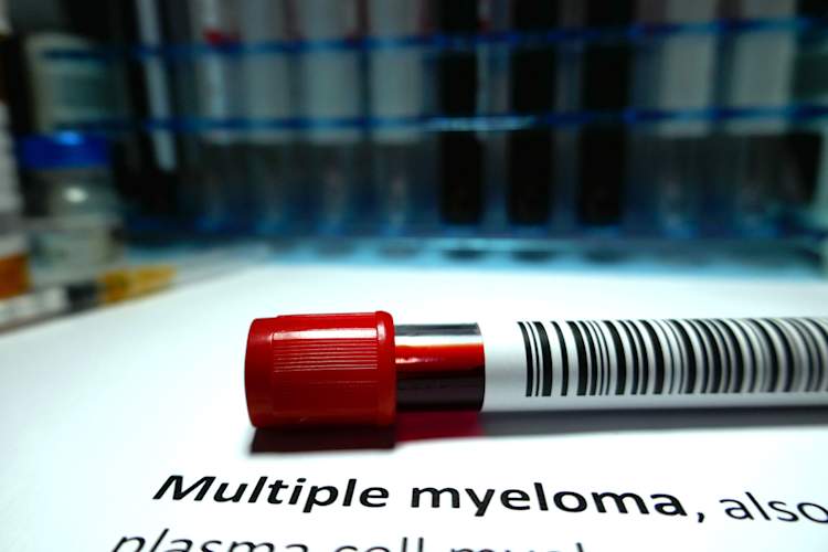 骨髓瘤样本