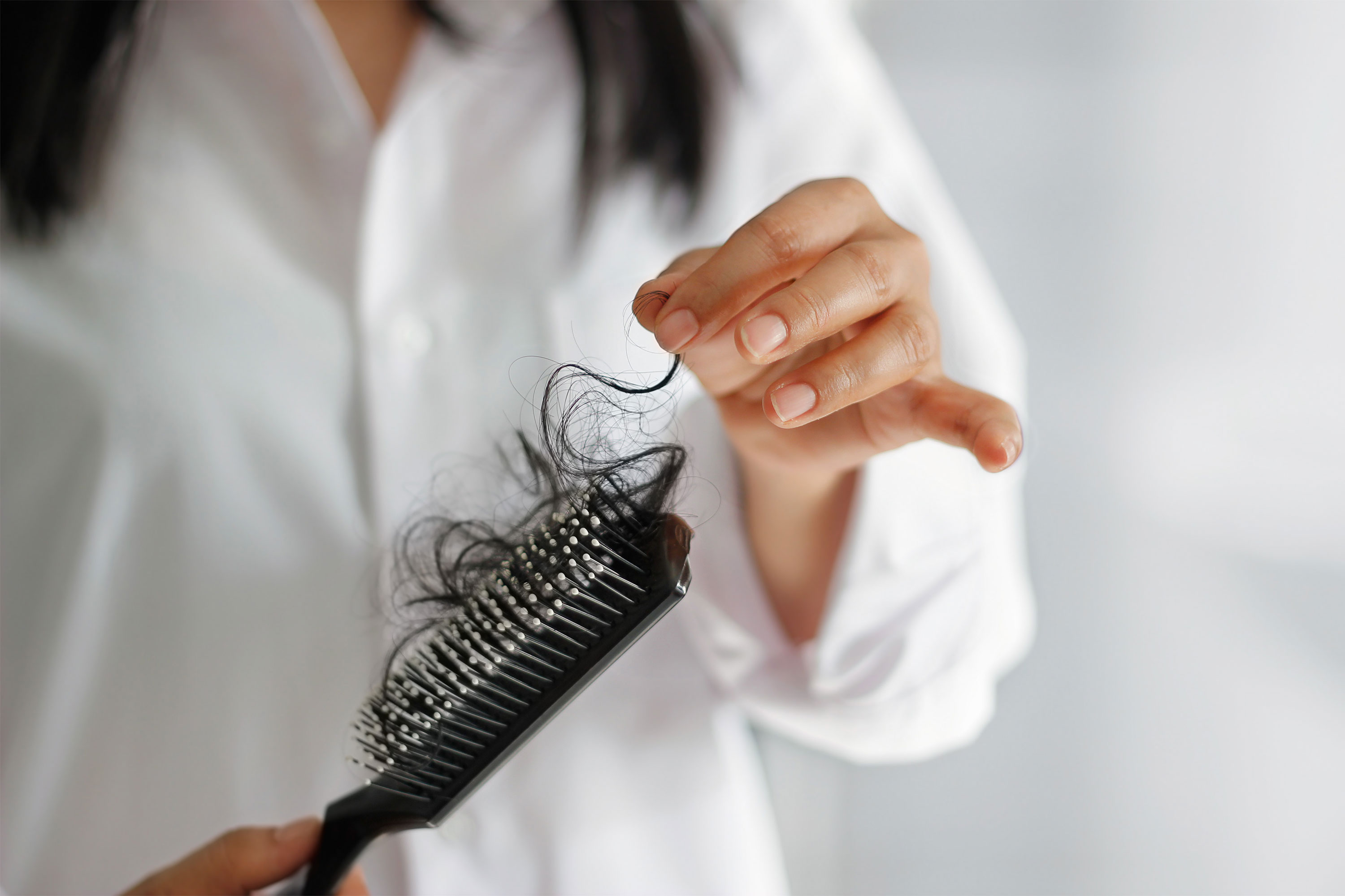 What Is Alopecia and What Causes Hair Loss?