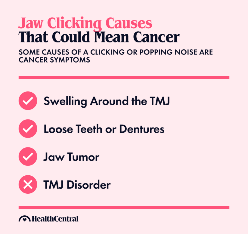 颚癌的症状是颞下颌关节周围肿胀，牙齿或假牙松动，颚肿瘤是颚癌的症状