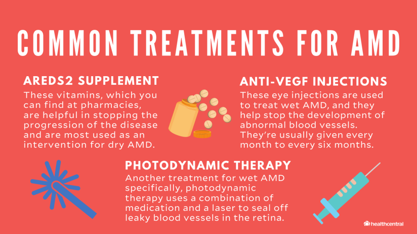 AMD的常见治疗包括AREDS2补充剂，抗VEGF注射和光动力疗法