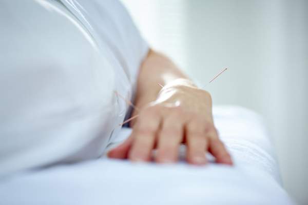 女人的手臂用针刺