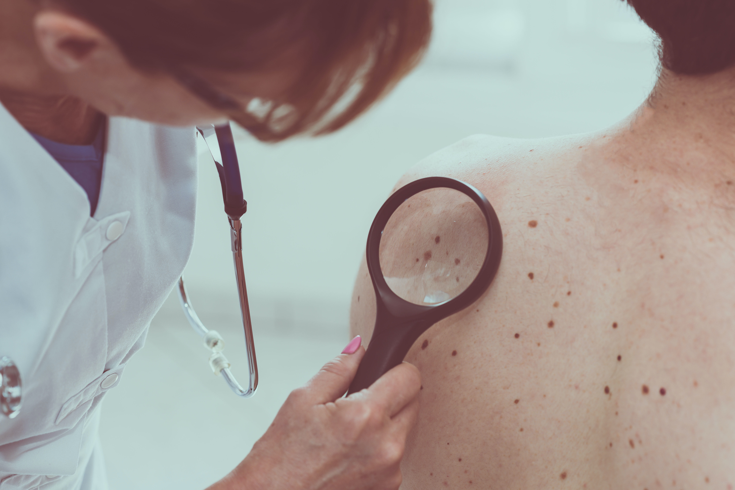 skin cancer symptoms pictures and signs