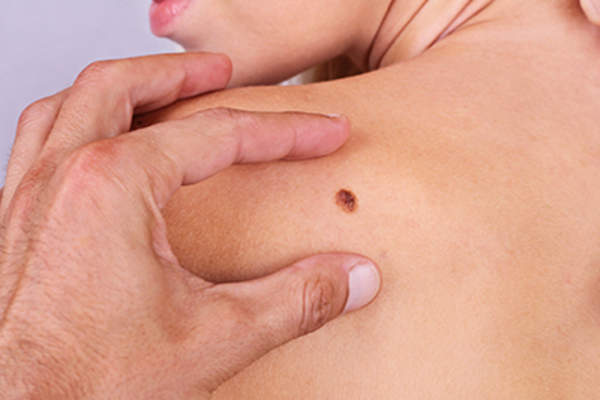 医生看着在女人的肩膀摩尔。