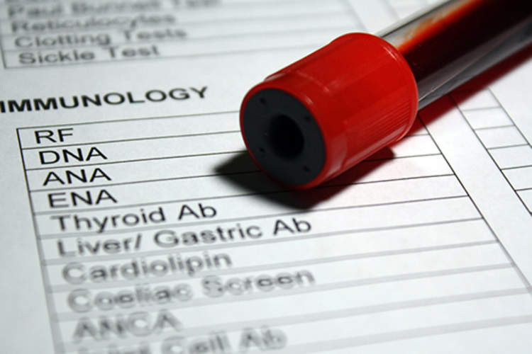 甲状腺验血的形式。