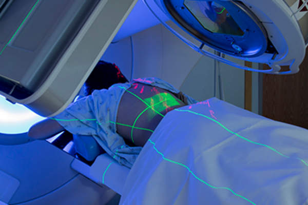 接受放射治疗的病人。