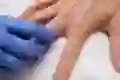 A doctor examines a person’s hand