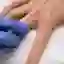 A doctor examines a person’s hand