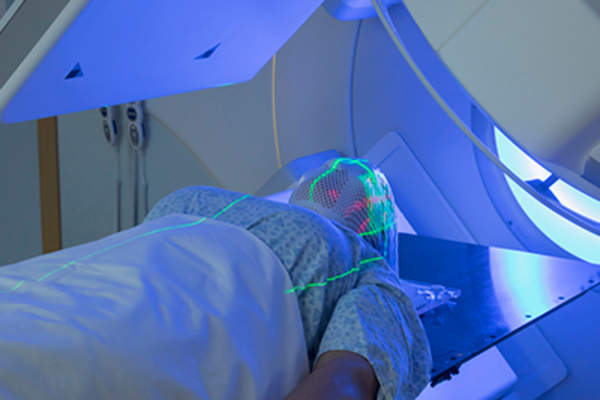 接受放射治疗的妇女。