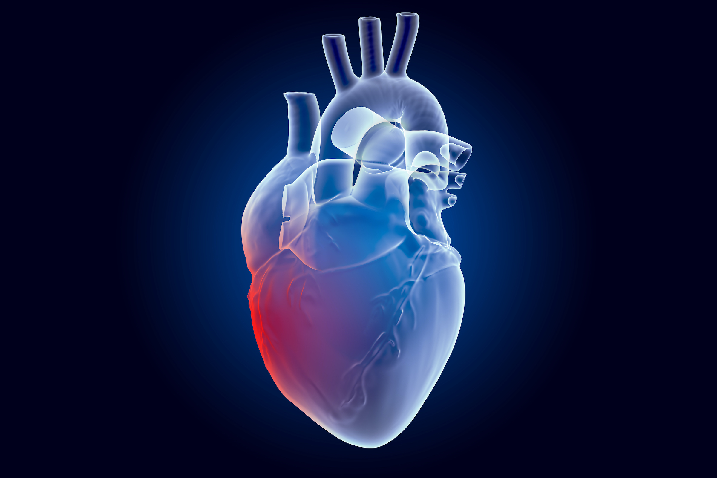 Can Rheumatoid Arthritis Cause Heart Failure