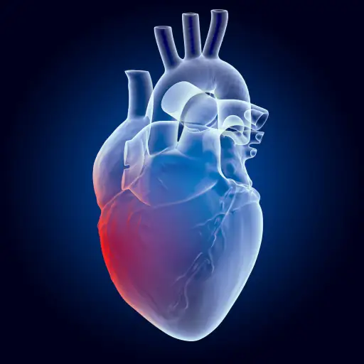 heart inflammation
