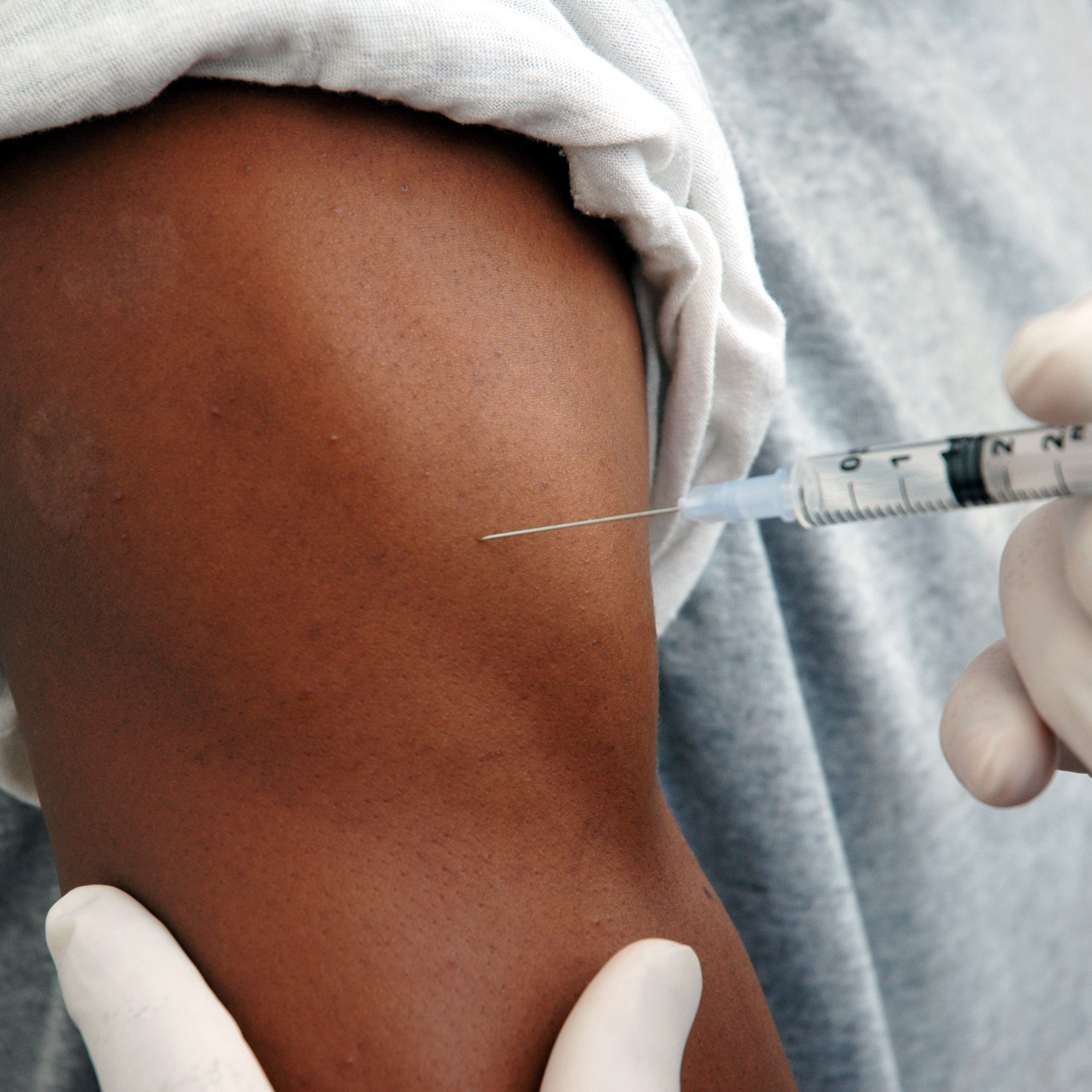 注射手臂的特写