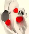 心脏瓣膜