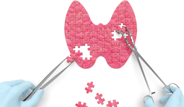 甲状腺手术的概念。