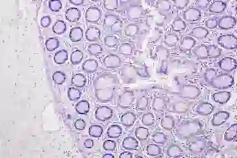 结肠癌的微观视图