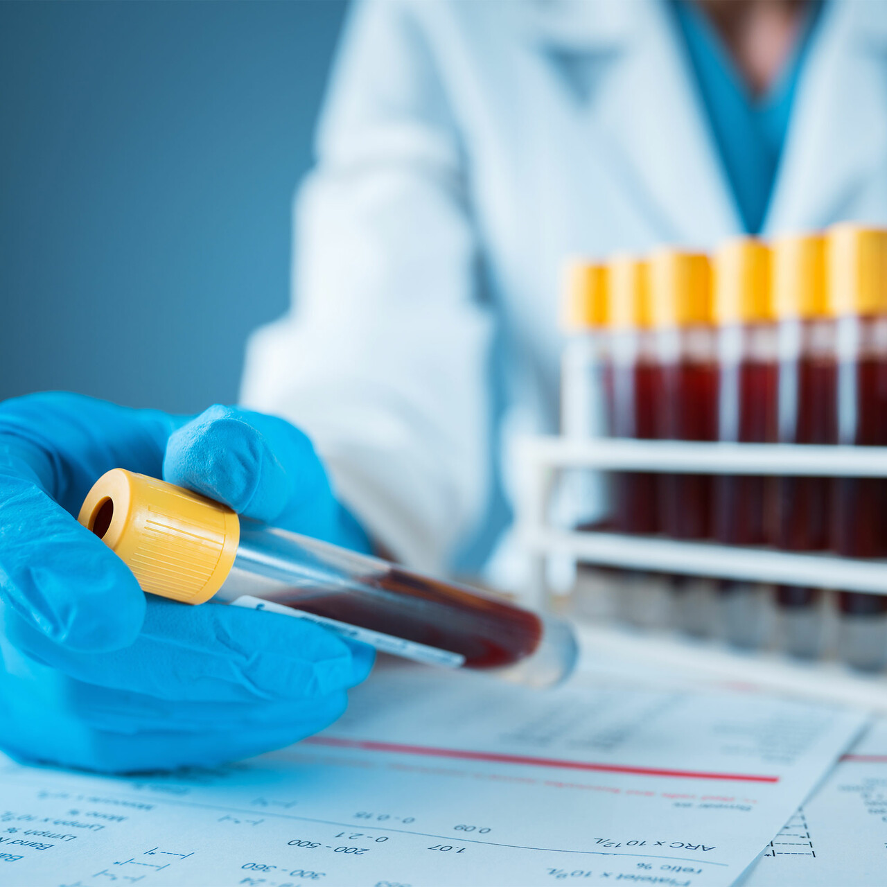 一个视图的血液试管和实验室结果