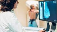 医生乳房X光检查时看着监视器