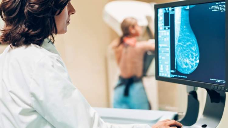 医生在乳房X光检查时看监视器