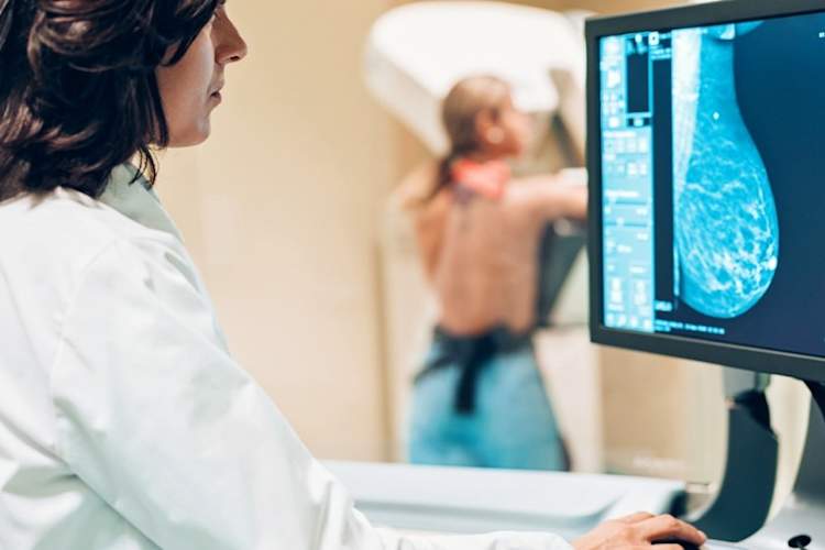 医生在乳房X光检查时看监视器