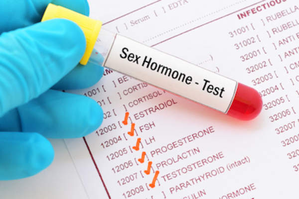 性激素验血。