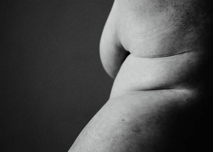 皮肤化脓性汗腺炎。“>
</picture></a>
</header>
<section>
<small>再问一个问题</small>
<h4><a href=