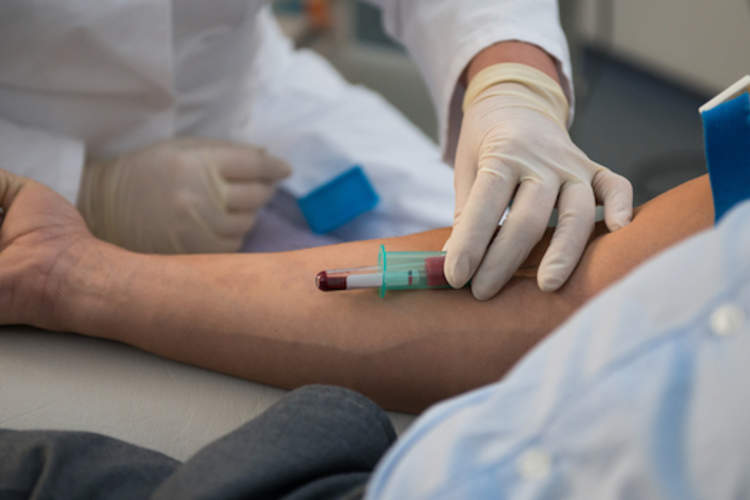 护士从患者抽血样本用于测试。