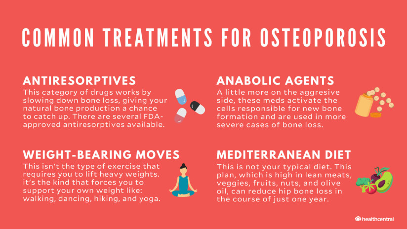 常见的骨质疏松症的治疗方法包括antiresorptives、合成代谢代理负重运动,地中海饮食。