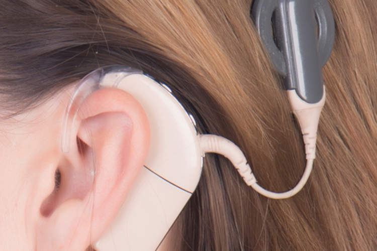 人工耳蜗可能有助于解除忧郁