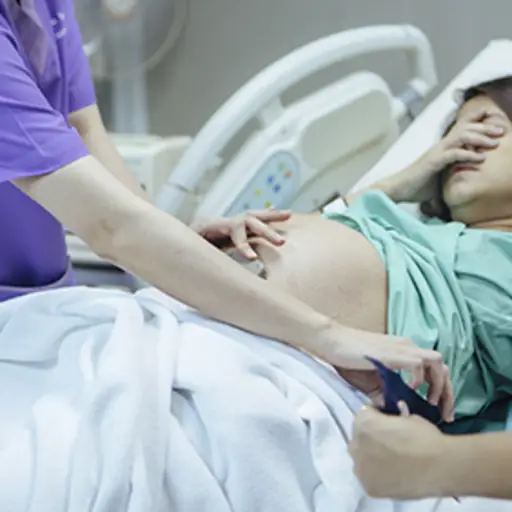在分娩时体验并发症的妇女。
