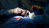 心脏手术异种瓣膜置换术