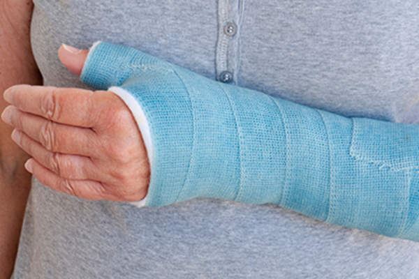 手臂骨折,打了石膏。