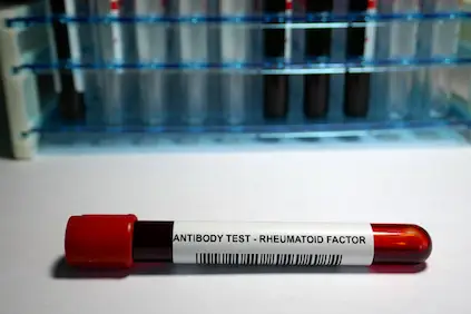 rf血液测试小瓶