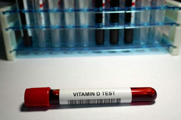 血液小瓶标记维生素d测试