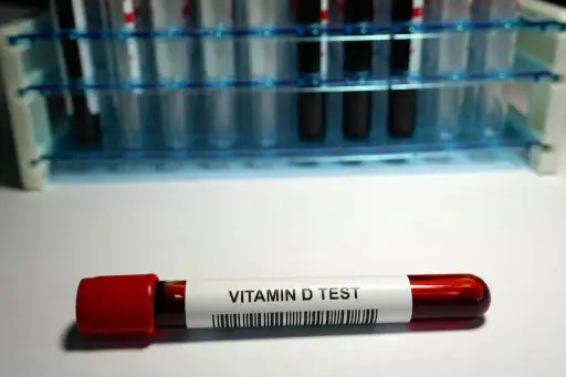 为维生素D测试标记的血液小瓶