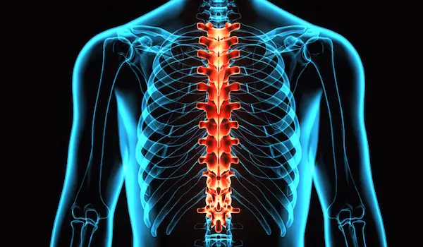 高亮线性脊柱压缩骨折可引起呼吸故障