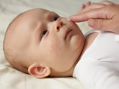 母亲把化妆水对婴儿的脸上湿疹。