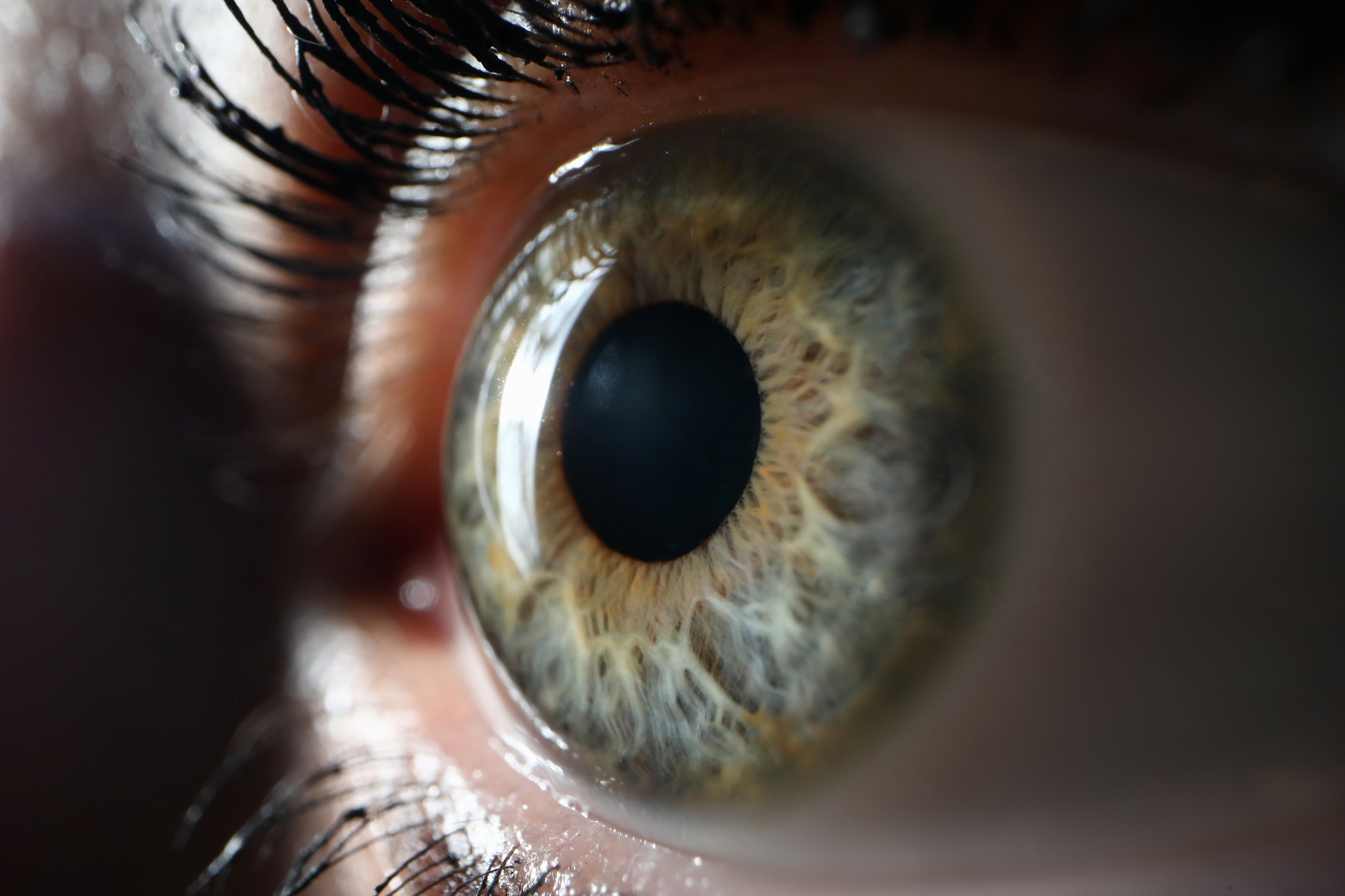 Diabetic Eye Disease: What to Expect