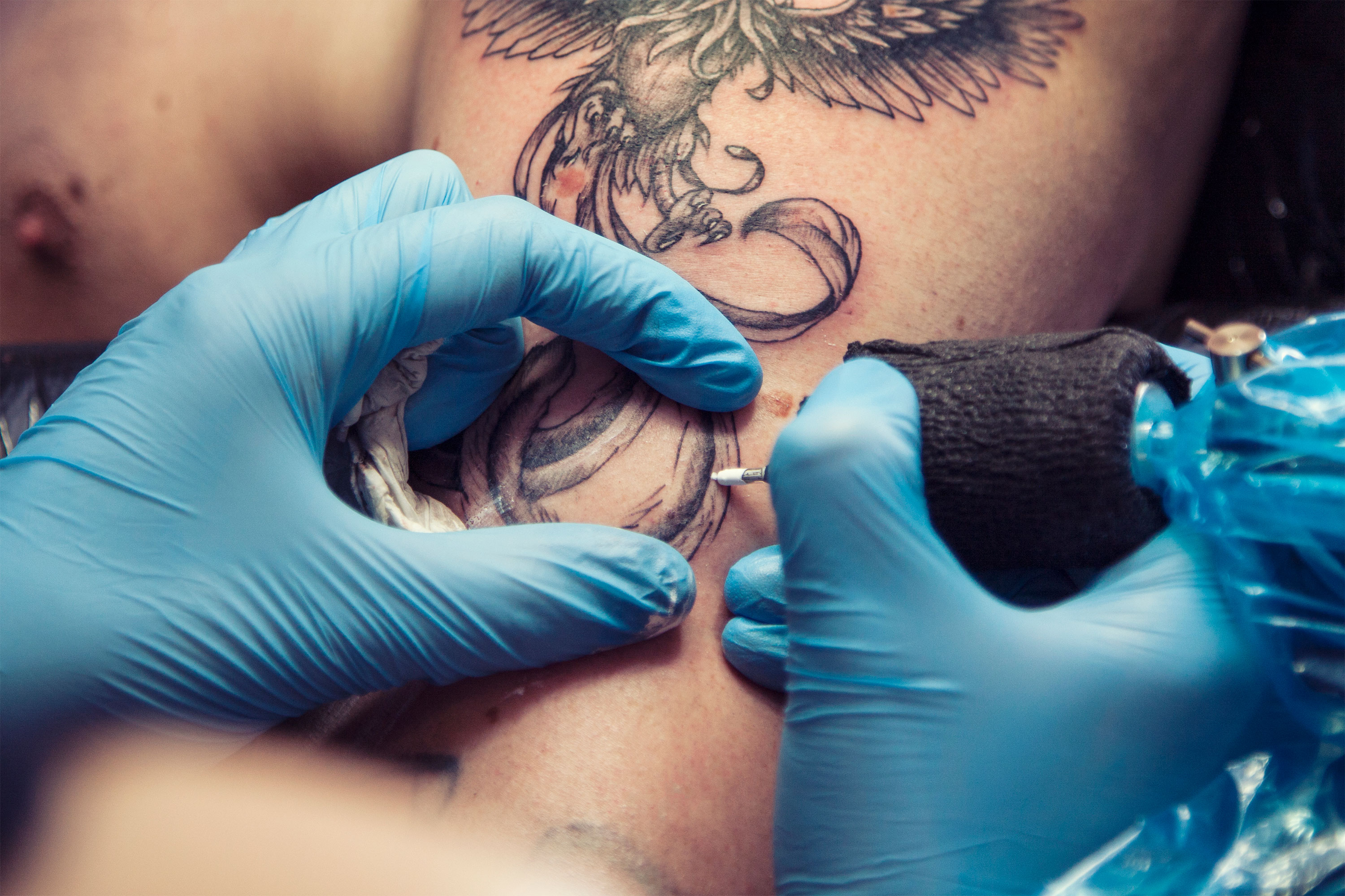 Can Tattoos Make Melanoma Harder to Detect?