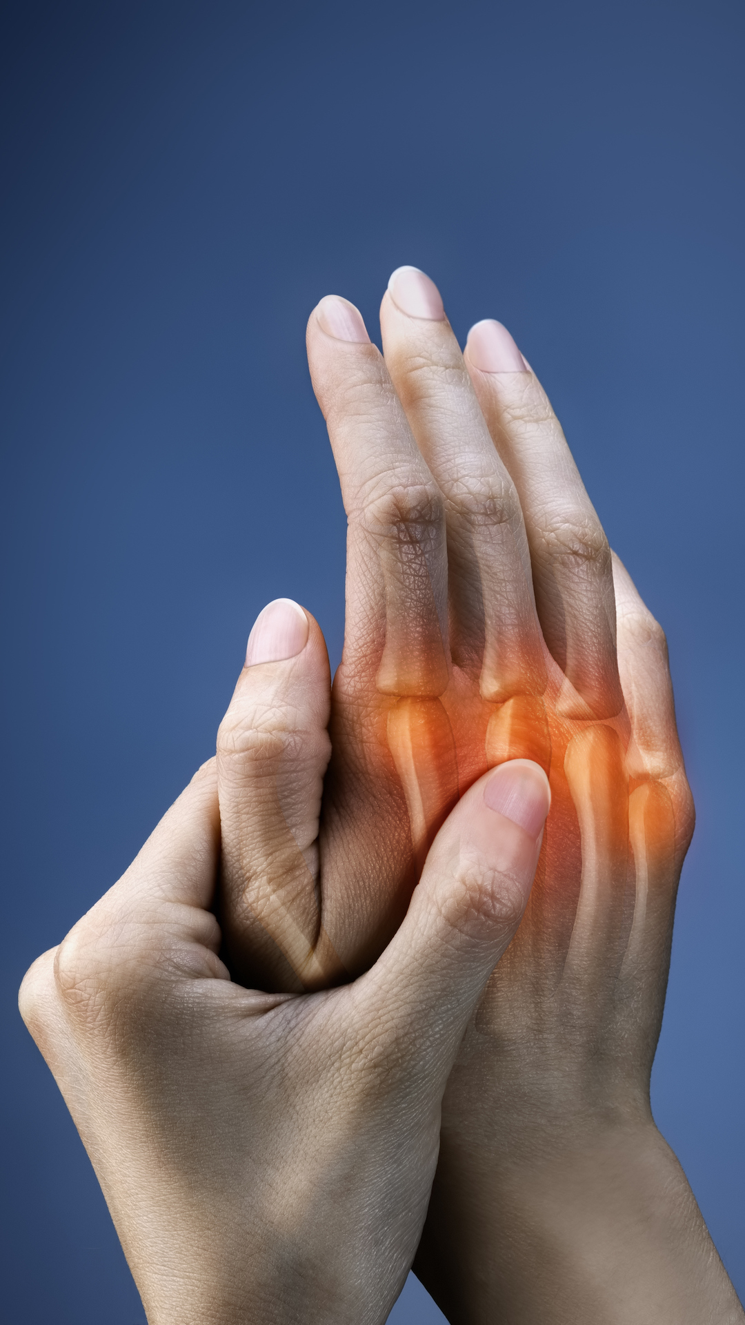 Arthritis in the Fingers and Knuckles: Pictures and Symptoms